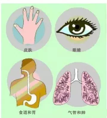 ?；坟洿? /><br /></p><p></p><p><strong>日常使用危險(xiǎn)化學(xué)品要注意什么</strong></p><p>許多危險(xiǎn)化學(xué)品具有毒性和腐蝕性，因此在使用危險(xiǎn)化學(xué)品時(shí)應(yīng)盡量避免直接接觸，不要用化學(xué)溶劑去洗手，更不要誤服，特別是接觸到腐蝕性化學(xué)品要立即用大量的水沖洗;?；坟涍\(yùn)易燃易爆場(chǎng)所禁止使用明火;在火災(zāi)、爆炸危險(xiǎn)的工作場(chǎng)所，不要穿化纖服裝或帶鐵釘?shù)男?，因?yàn)榛w服裝會(huì)產(chǎn)生靜電，鞋釘撞擊地面會(huì)產(chǎn)生火花;鼠藥隨意亂扔，可能會(huì)使其他人誤服中毒。</p><p style=